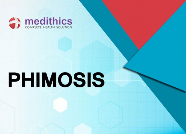 phimosis-what-it-is-some-probable-causes-and-it-s-treatment