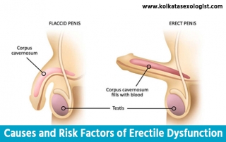 Causes and Risk Factors of Erectile Dysfunction